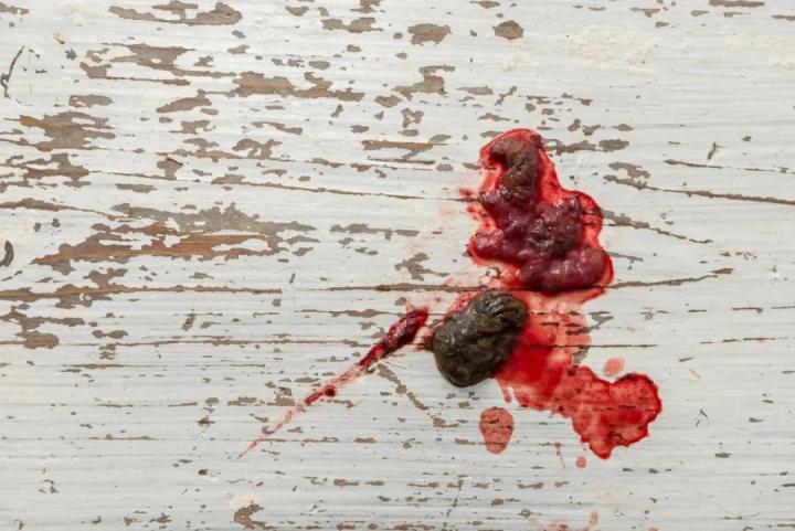My dog is pooping blood